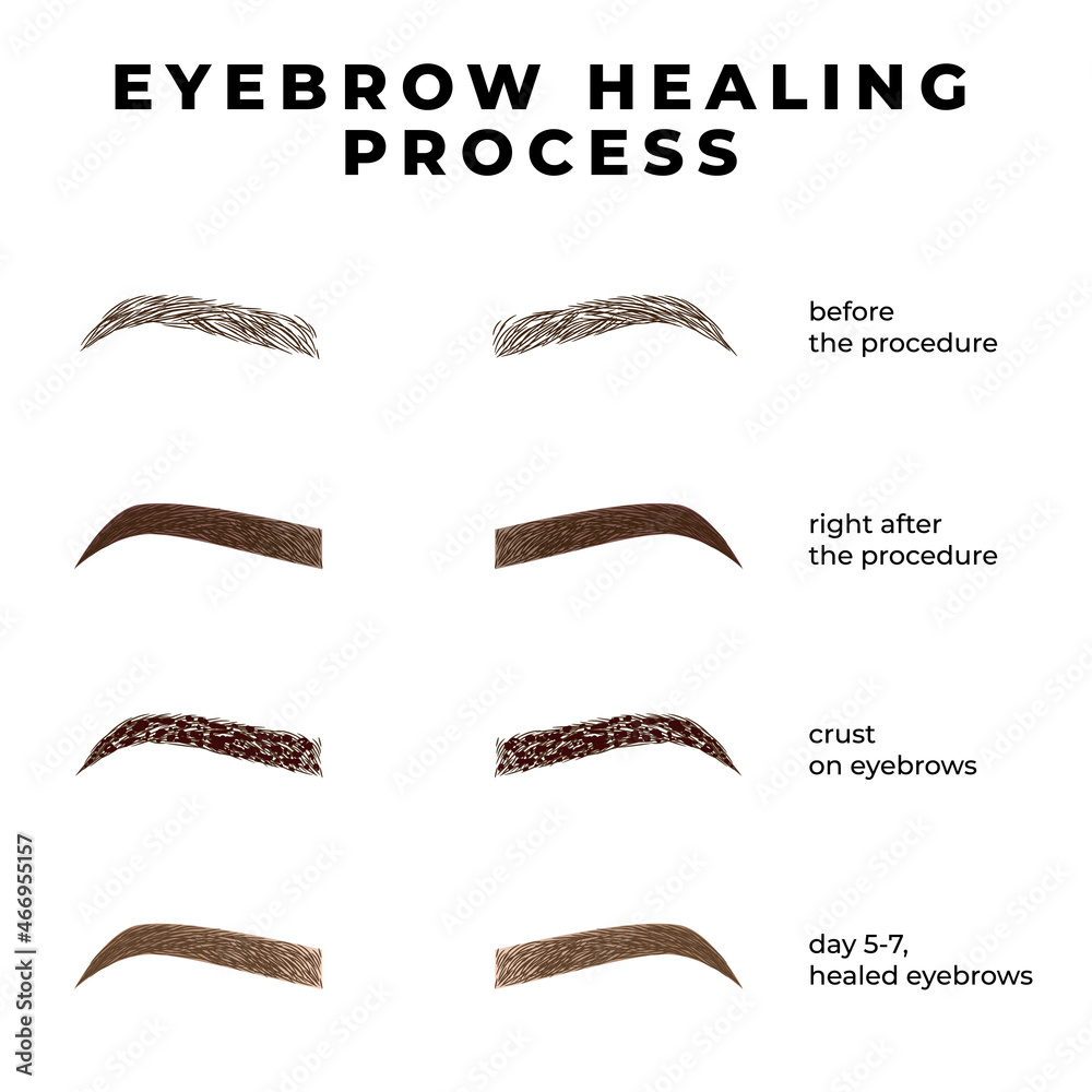Eyebrows healing process after microblading. Healing stages eyebrows