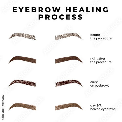 Eyebrows healing process after microblading. Healing stages eyebrows. 