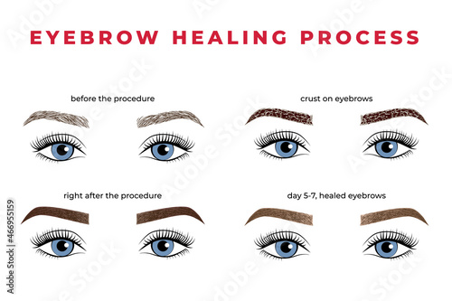 The eyebrow healing process after permanent makeup. Illustration brows with eyes