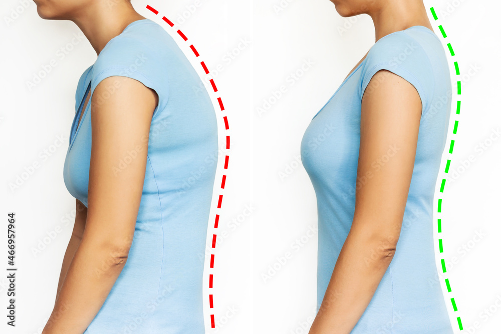 A young woman stands bent and straightened isolated on a white background. Correct and incorrect spine position. Slouching back and healthy spine. A posture before and after changing. Scoliosis - obrazy, fototapety, plakaty 