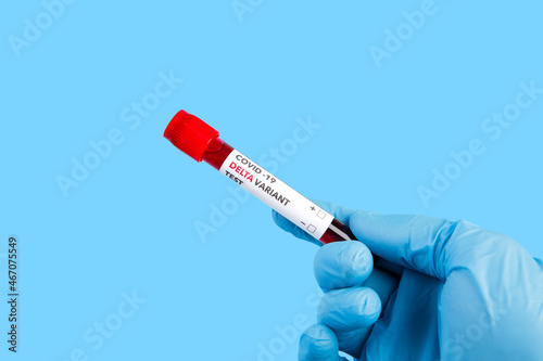 blood test with the label Covid-19 DELTA Variant.