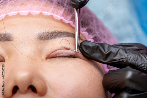 Cosmetic procedure for changing the shape of the eyes  lifting and strengthening the skin of the eyelids. Non-surgical blepharoplasty with cosmetic threads. Anti-aging cosmetology. Asian eye size.