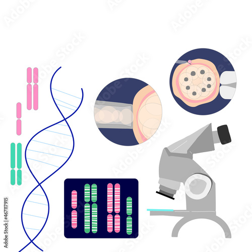 Vector colored illustration of PGD preimplantation genetic screening of embryon or morula oocyte