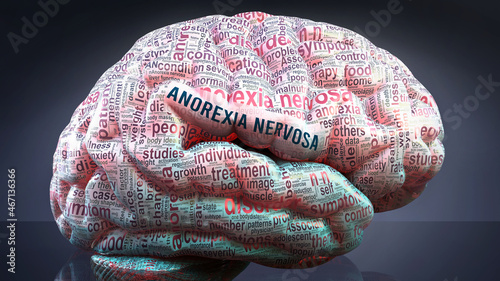 Anorexia nervosa in human brain, hundreds of terms related to Anorexia nervosa projected onto a cortex to show broad extent of this condition, 3d illustration photo