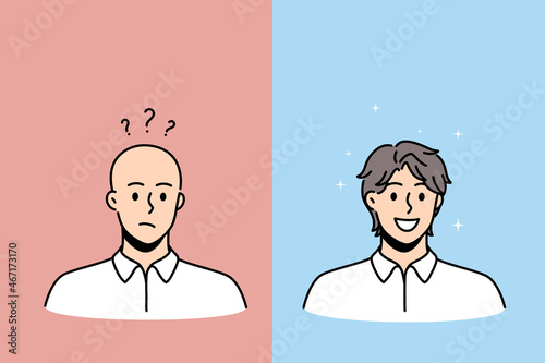 Hair loss and baldness concept. Faces of young completely bald man with frustrated mood and happy smiling hairy person vector illustration