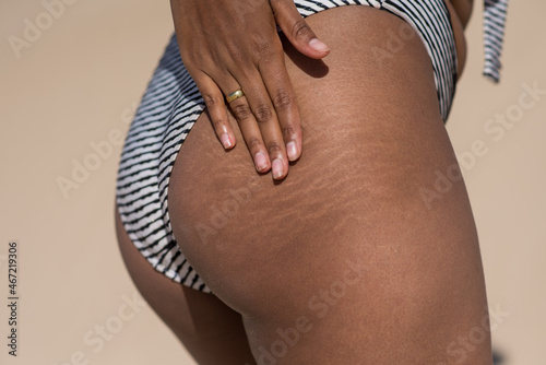 Woman embracing her stretch marks photo