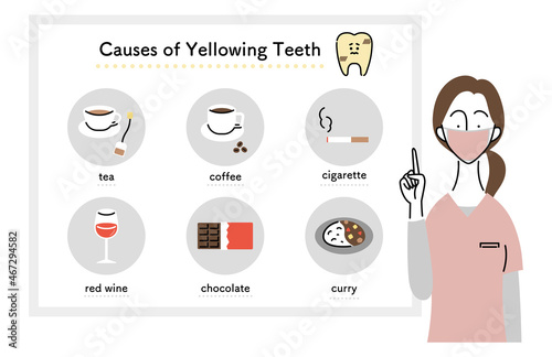 歯の黄ばみの原因について説明する女性歯科医（英語ver.）