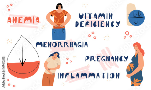 Causes of anemia in a woman. Infographics on iron deficiency in the body. Medical concept. Vector hand-drawn illustration.