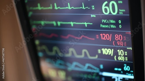 Hospital Patient's Vital Signs photo