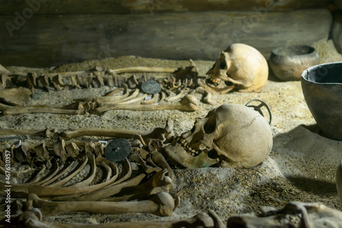 Fotografie A human skull and the remains of bones in the museum.