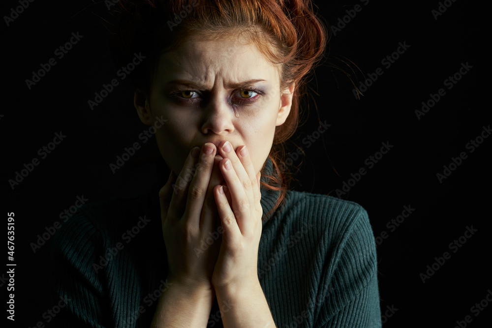 crying woman with black eye problems abuse crying woman with black eye problems abuse
