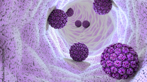 Human papillomavirus infection. Virus. HPV is the most common sexually transmitted infection globally. HPV infection is caused by human papillomavirus, a DNA virus from the papillomavirus family, 3d photo