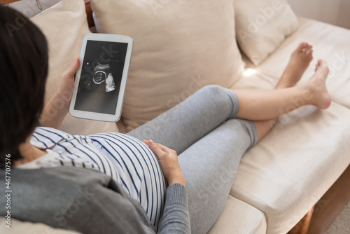 Asian pregnant woman lying on sofa looking at ultrasound scan photo on digital tablet.
