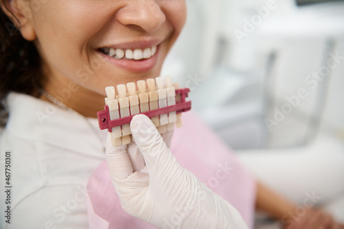 Close-up of dentist's hand holding tooth color chart near the face of patient smiling with beautiful toothy smile. Teeth whitening, bleaching, aesthetic dentistry, oral hygiene and dental care concept