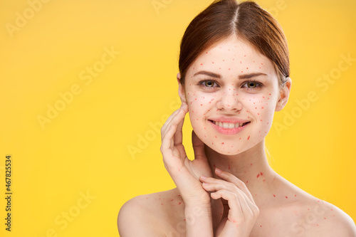 woman with bare shoulders red dots on her face health problems dermatology