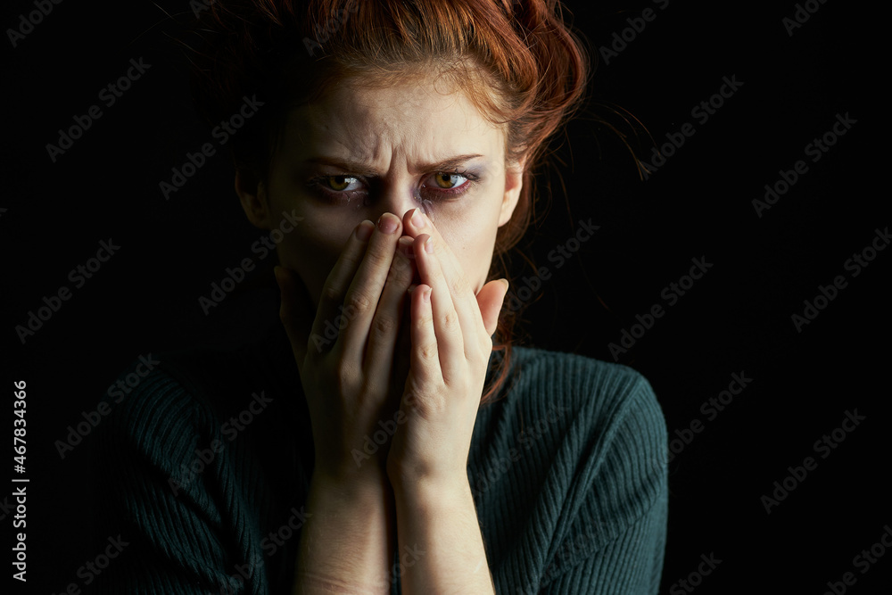 crying woman with black eye problems abuse crying woman with black eye problems abuse