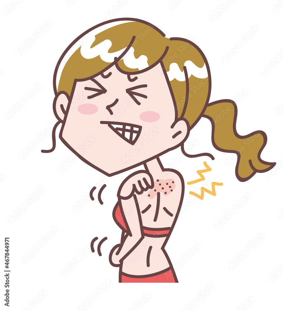 背中が乾燥して痒い女性 背中が乾燥して痒い女性