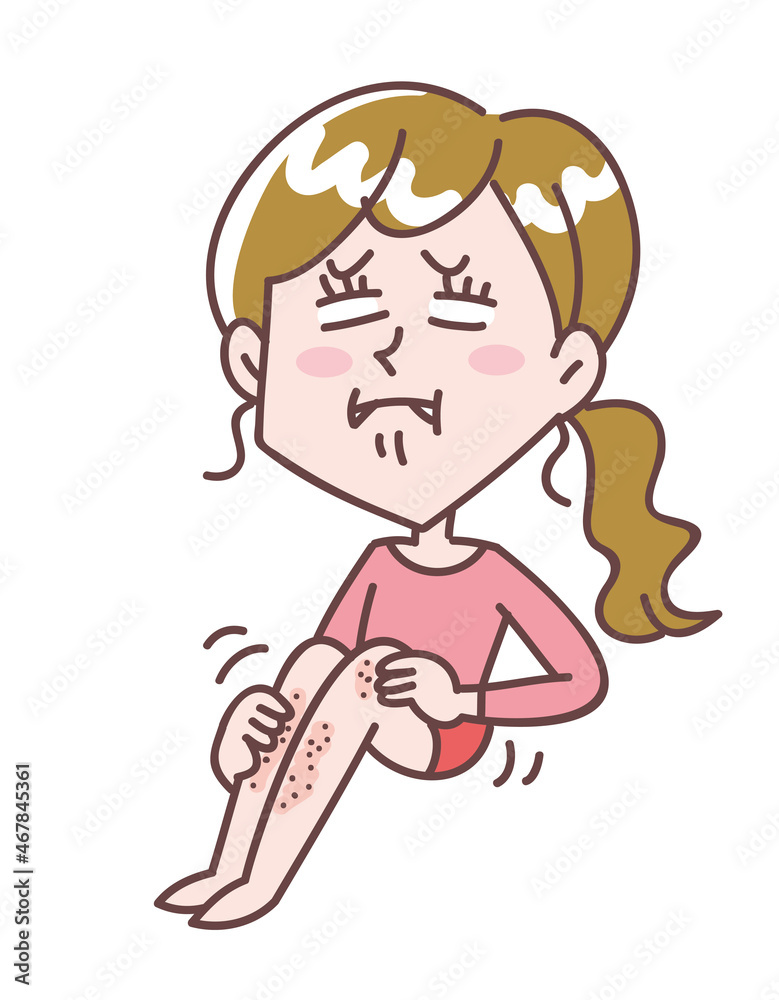 足が乾燥して痒い女性