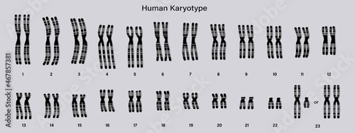 Human karyotype. Chromome structure. Male and Female. Biological study. photo
