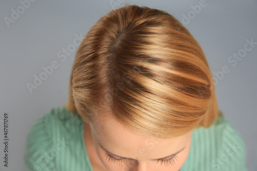 Woman with hair loss problem on grey background, above view. Trichology treatment