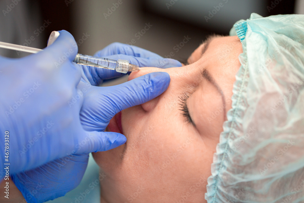 Cosmetic procedure for non-surgical rhinoplasty. Beautician injects hyaluronic acid into the nose with a syringe to change the shape of the nose, close-up. Plastic surgery. Cosmetic injections. Cosmetic procedure for non-surgical rhinoplasty. Beautician injects hyaluronic acid into the nose with a syringe to change the shape of the nose, close-up. Plastic surgery. Cosmetic injections.
