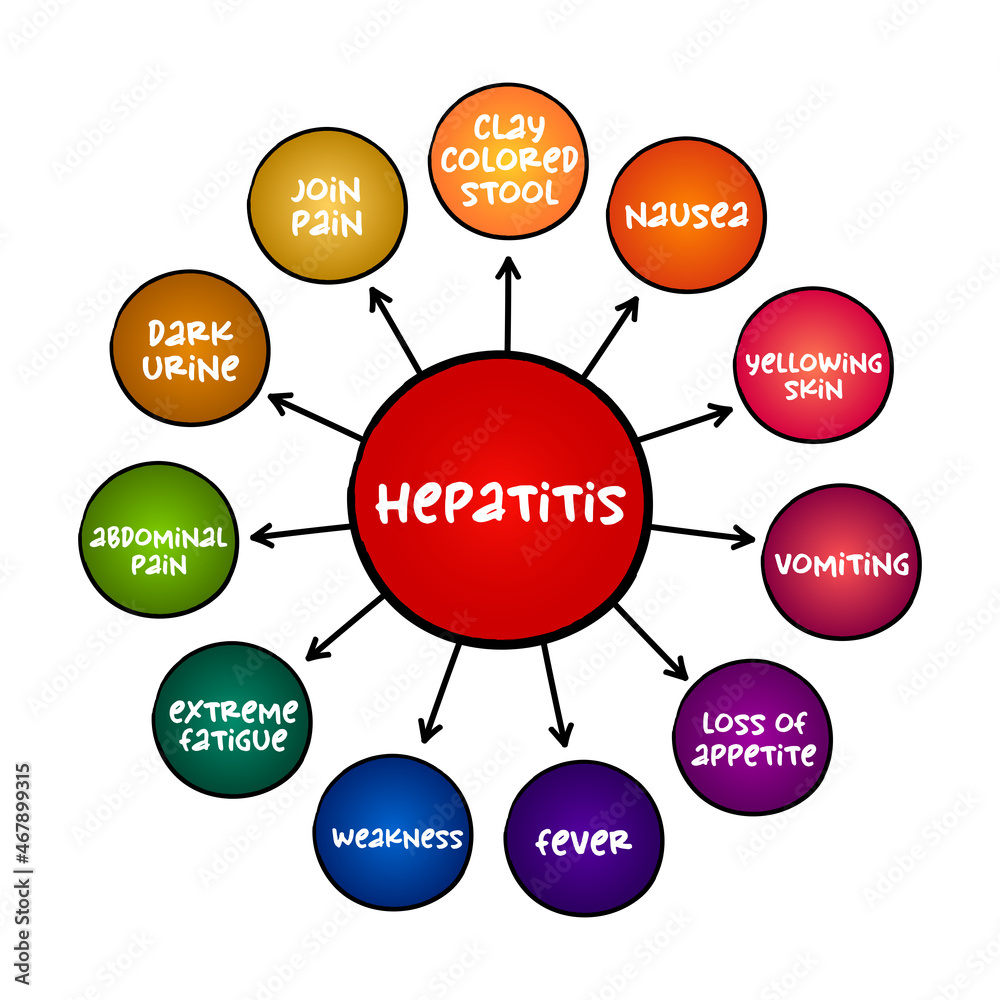 Hepatitis symptoms mind map, medical concept for presentations and ...