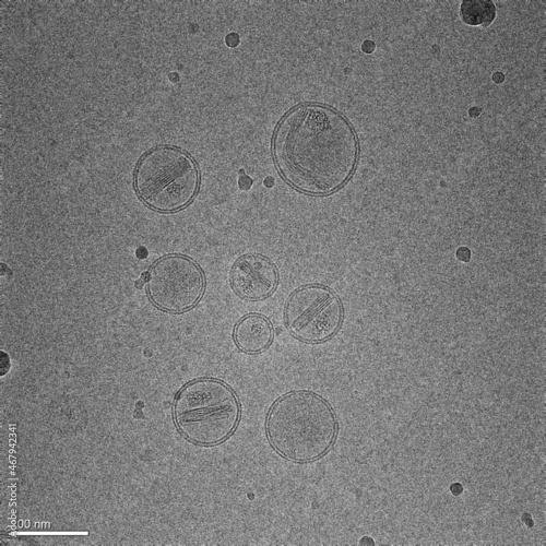 Micrograph represents nanoparticles made of lipids containing an anticancer drug photo