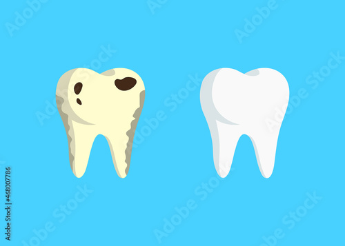 flat style illustration of healthy white tooth and yellow tooth with caries on a blue background. concept of comparing teeth, caries treatment before after