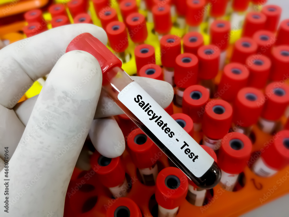 Biochemist or scientist hold blood sample for Salicylate test in