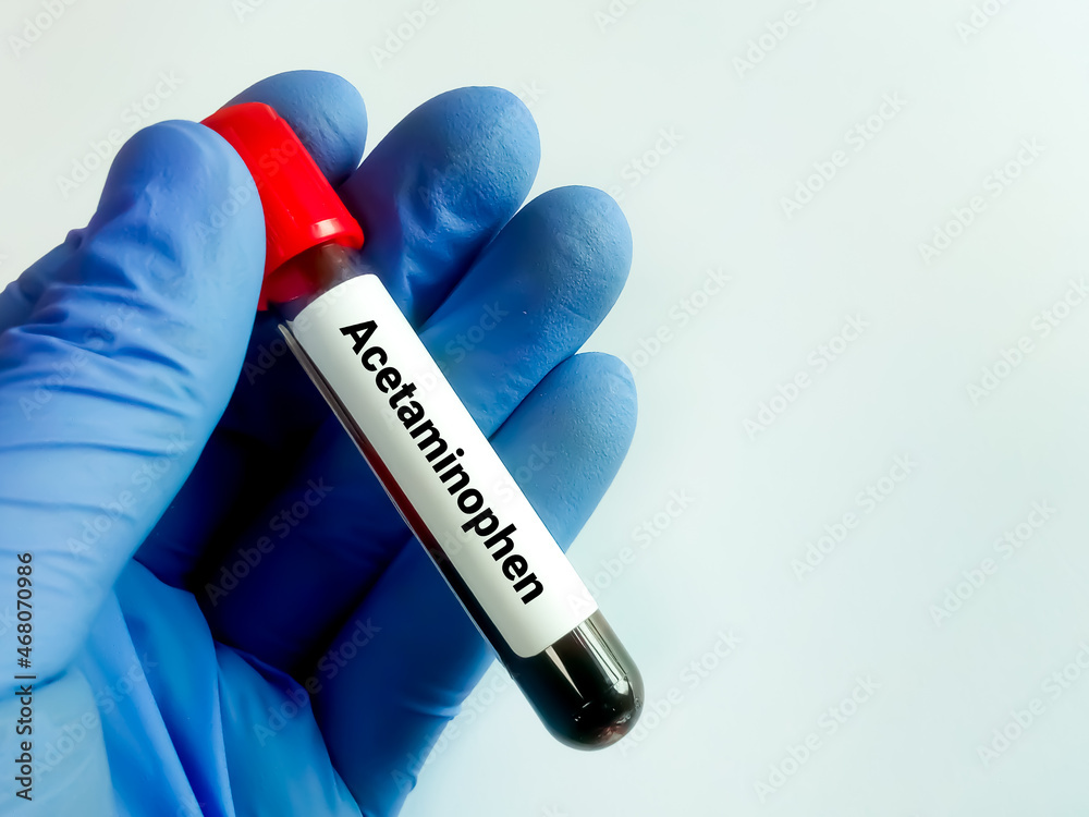 Fototapeta premium Hand hold Blood sample for Somatostatin test.