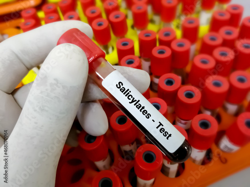 Biochemist or scientist hold blood sample for Salicylate test in laboratory. Diagnosis salicylate intoxication due to an overdose of aspirin.