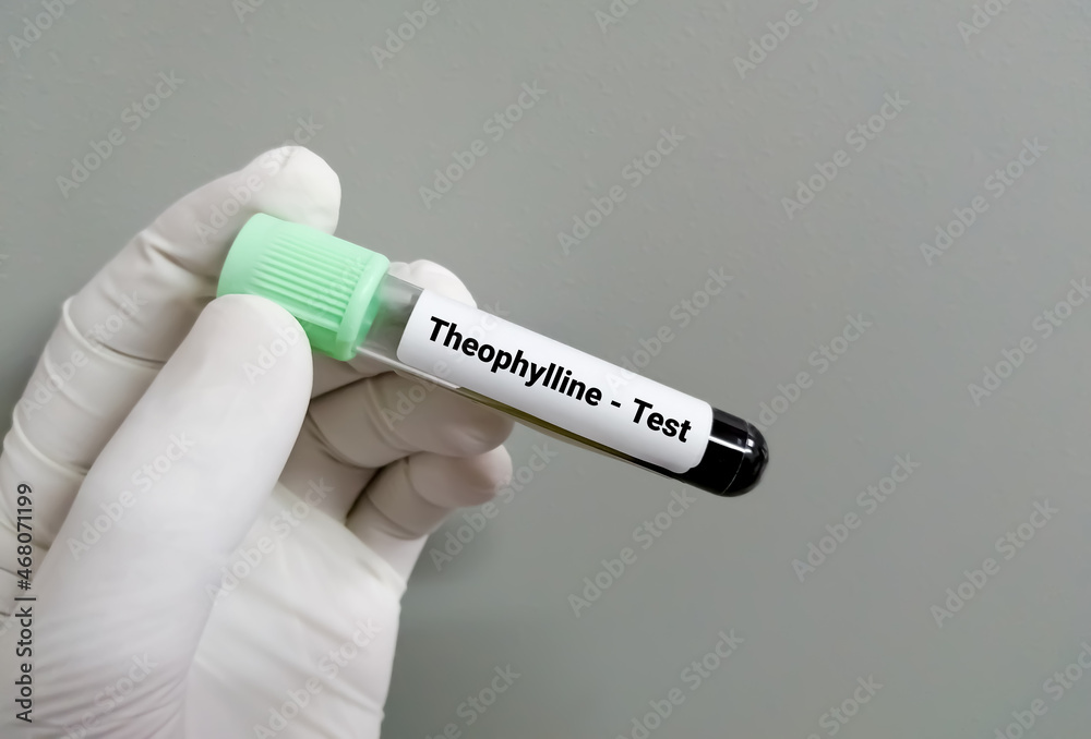 Fototapeta premium Blood sample for Theophylline test, drug therapy.