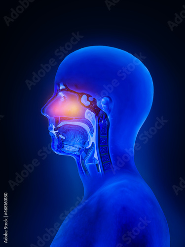 Flu - Full Nose Human Sinuses Anatomy, colds, allergies, nasal anatomy, flu,sinusitis,treatment of the upper respiratory tract, 3d render