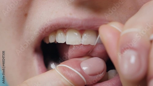Close-up shot of a woman flossing her teeth while removing leftover food from the interdental space