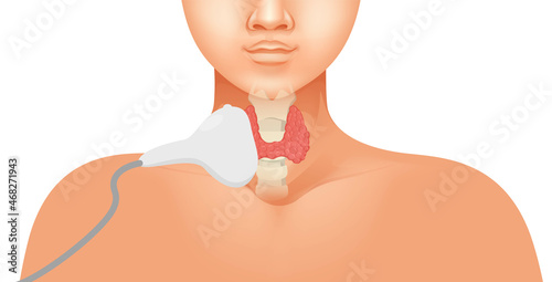 Thyroid ultrasound vector illustration. Linear array transducer is placed on the human neck