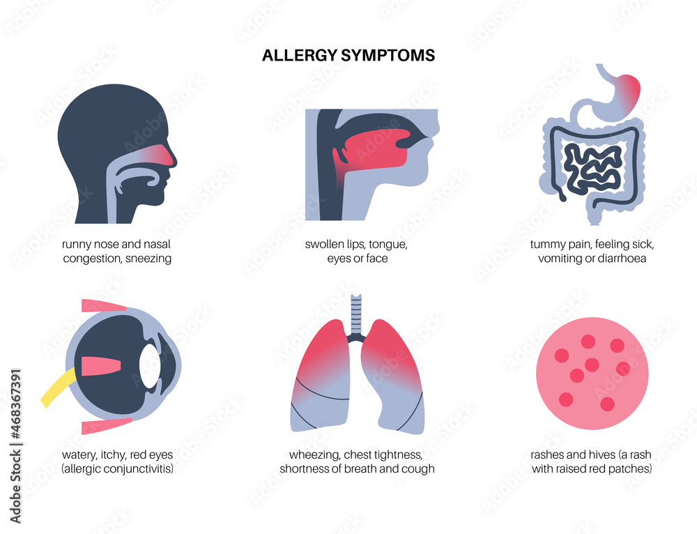 Allergy symptoms concept