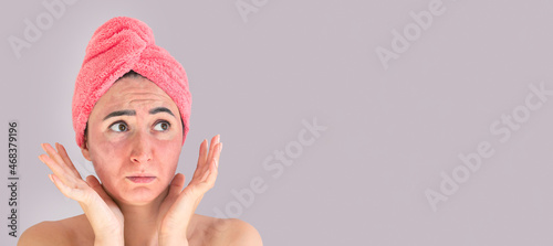 Banner woman face with skin irritation problem photo