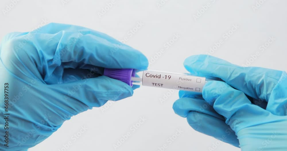 blood test with the label Covid-19 DELTA Variant. blood test with the label Covid-19 DELTA Variant.