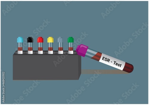Blood sample for erythrocyte sedimentation rate (ESR) test. Medical test tube in laboratory background. photo