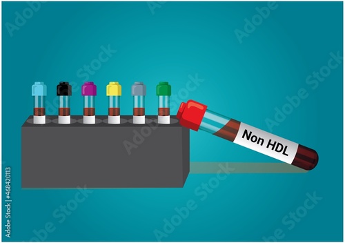 Blood sample test tube for Non-HDL test with laboratory background. Healthcare and medical test concept. 