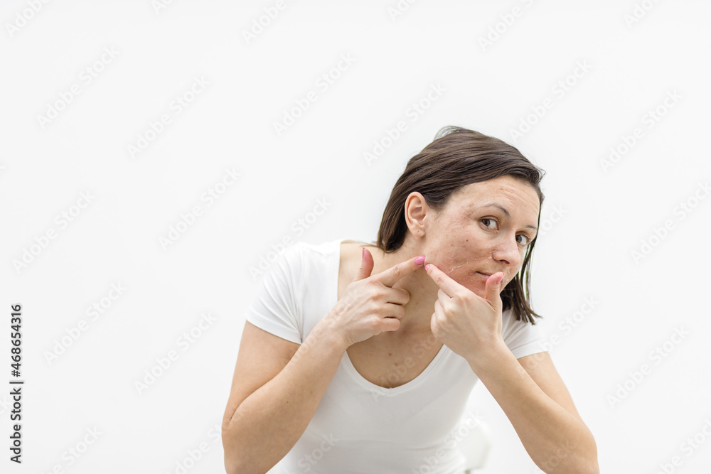 Photo of woman with acne problem squeezing pimple indoors. Photo of woman with acne problem squeezing pimple indoors.