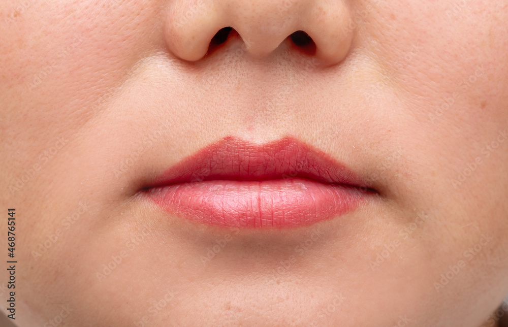 Fototapeta premium Lip augmentation. Beautician injects hyaluronic acid into the lips of a girl with a syringe. The cosmetologist doctor performs the procedure in the cosmetology office. Plastic surgery.