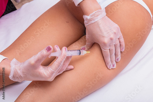 application of enzymes for cellulite. Woman undergoing intradermotherapy to reduce cellulite