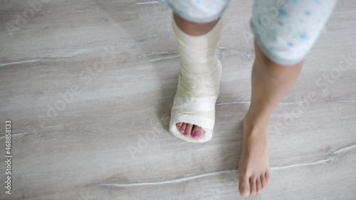 Close up view - legs of a woman with a broken leg in plaster trying to walk in the living room. Woman is at rehabilitation at home after an accident photo