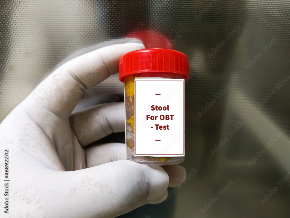 Fecal occult blood test (FOBT). Doctor holding sample container with