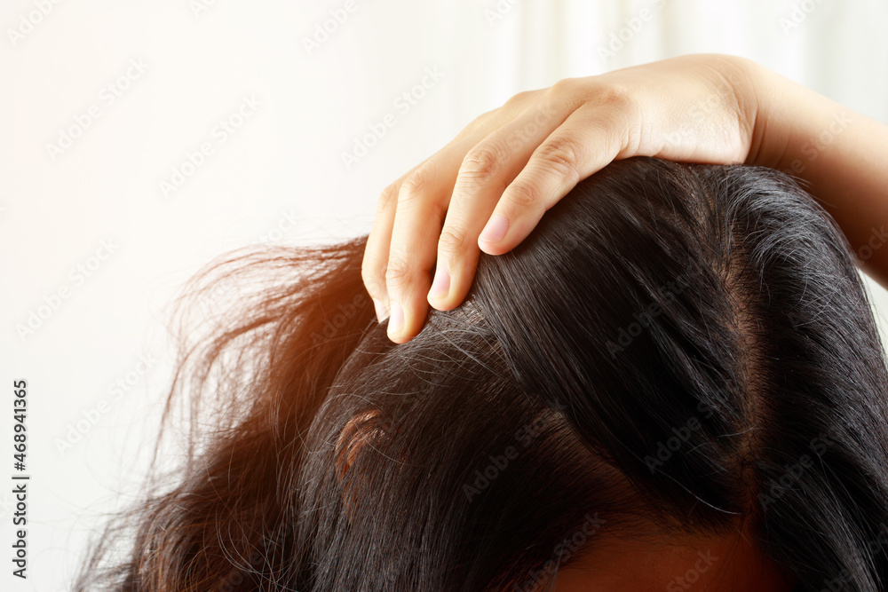 A woman has problems with hair and scalp,she has dandruff from allergic reactions to shampoos. and hair conditioner A woman has problems with hair and scalp,she has dandruff from allergic reactions to shampoos. and hair conditioner