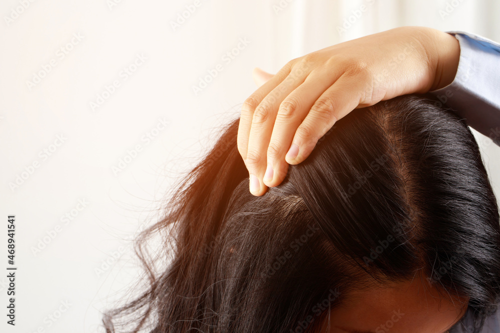 Obraz premium A woman has problems with hair and scalp,she has dandruff from allergic reactions to shampoos. and hair conditioner