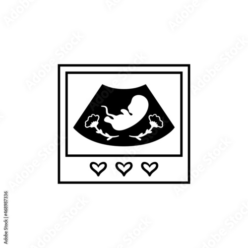 Ultrasound of baby in mother's womb. Pregnancy ultrasound concept symbol. Pregnancy and health, examination procedure of embryo, placenta, umbilical cord. Vector illustration.