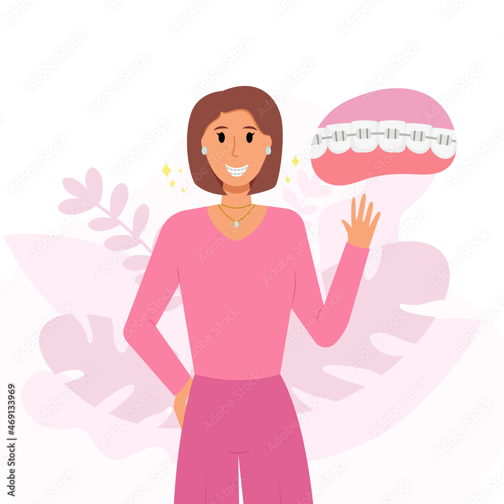 Young beautiful woman in braces. Orthodontic attachment. Cartoon dental brace. Woman wears metal braces. Vector illustration. Young beautiful woman in braces. Orthodontic attachment. Cartoon dental brace. Woman wears metal braces. Vector illustration.