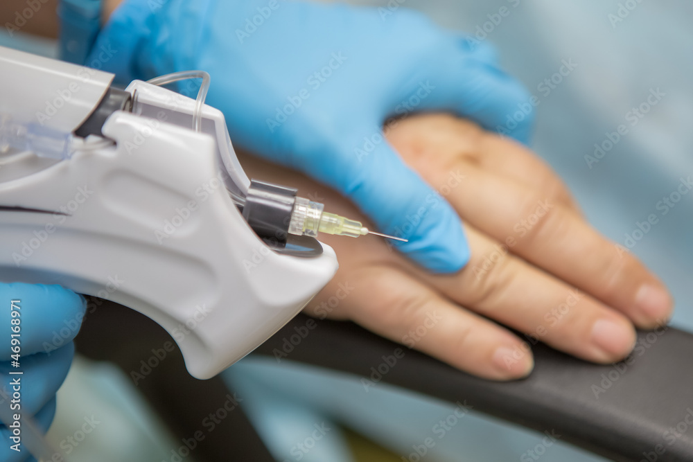 The doctor injects carbon dioxide using a needle machine into the skin of the patient's hand. Carboxytherapy. Treatment and rejuvenation of the skin of the hands. Tunnel syndrome, dry skin of the